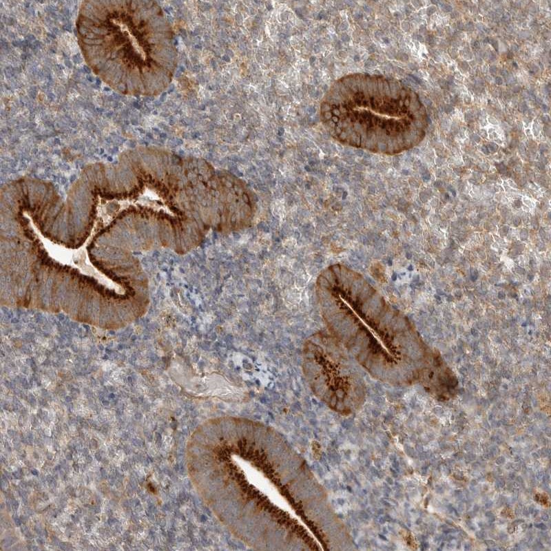 Anti-ZNF232 Antibody