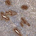 Anti-ZNF232 Antibody