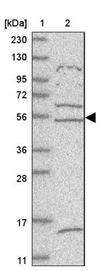 Lane 1: Marker [kDa] 230, 130, 95, 72, 56, 36, 28, 17, 11_br/_Lane 2: Human cell line RT-4