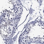 Anti-USP26 Antibody