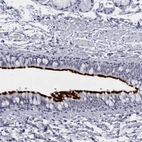 Immunohistochemical staining of human bronchus shows strong positivity in respiratory epithelial cells.