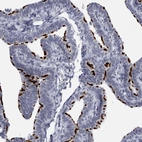 Immunohistochemical staining of human Fallopian tube shows strong positivity in cilia in glandular cells.