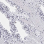 Immunohistochemical staining of human prostate shows no positivity in glandular cells as expected.