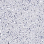 Immunohistochemical staining of human liver shows no positivity in hepatocytes as expected.
