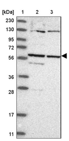Lane 1: Marker [kDa] 230, 130, 95, 72, 56, 36, 28, 17, 11_br/_Lane 2: Human cell line RT-4_br/_Lane 3: Human cell line U-251MG sp