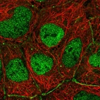 Immunofluorescent staining of human cell line HEK 293 shows localization to nucleoplasm, cell junctions & vesicles.