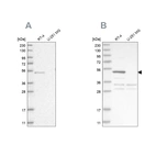 Western blot analysis using Anti-SCP2 antibody HPA027317 (A) shows similar pattern to independent antibody HPA027135 (B).