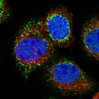 Immunofluorescent staining of human cell line A-431 shows localization to nucleoplasm & peroxisomes.