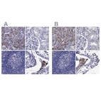 Immunohistochemical staining of human adrenal gland, kidney, lymph node and testis using Anti-STAR antibody HPA027318 (A) shows similar protein distribution across tissues to independent antibody HPA023644 (B).