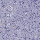 Anti-STAR Antibody