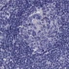 Immunohistochemical staining of human lymph node using Anti-STAR antibody HPA027318.