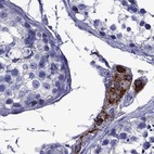 Immunohistochemical staining of human testis using Anti-STAR antibody HPA027318.