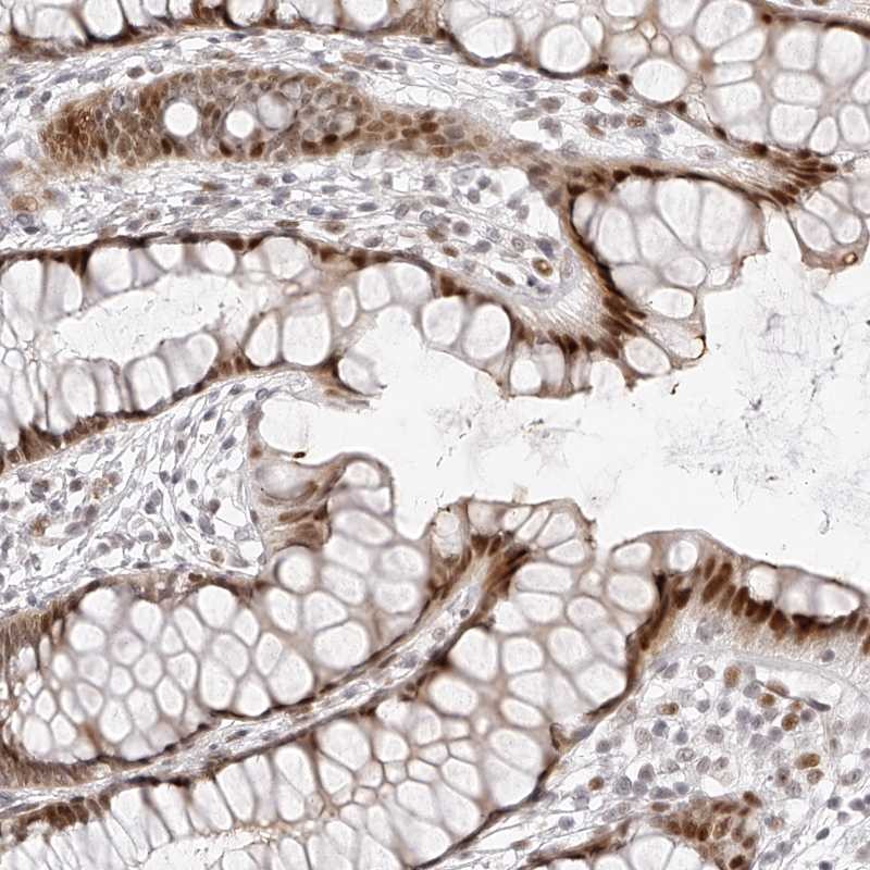 Anti-PLEKHG1 Antibody