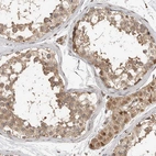 Immunohistochemical staining of human testis shows moderate cytoplasmic positivity in cells in seminiferous ducts.
