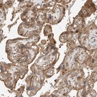 Immunohistochemical staining of human placenta shows moderate membranous positivity in trophoblastic cells.