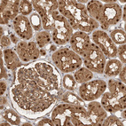 Immunohistochemical staining of human kidney shows moderate cytoplasmic, moderate membranous and strong nuclear positivity in cells in tubules.