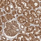 Immunohistochemical staining of human kidney shows moderate cytoplasmic, moderate membranous and strong nuclear positivity in cells in tubules.