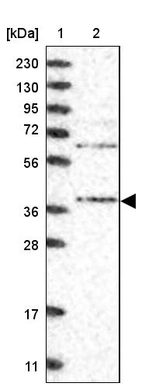 Lane 1: Marker [kDa] 230, 130, 95, 72, 56, 36, 28, 17, 11_br/_Lane 2: Human cell line RT-4
