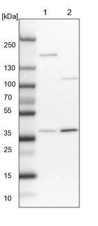 Lane 1: NIH-3T3 cell lysate (Mouse embryonic fibroblast cells)_br/_Lane 2: NBT-II cell lysate (Rat Wistar bladder tumour cells)