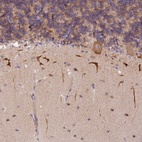 Anti-S100PBP Antibody