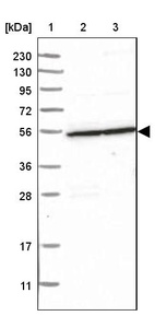 Lane 1: Marker [kDa] 230, 130, 95, 72, 56, 36, 28, 17, 11_br/_Lane 2: Human cell line RT-4_br/_Lane 3: Human cell line U-251MG sp