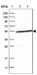 Lane 1: Marker [kDa] 230, 130, 95, 72, 56, 36, 28, 17, 11_br/_Lane 2: Human cell line RT-4_br/_Lane 3: Human cell line U-251MG sp