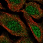 Anti-VPS13D Antibody