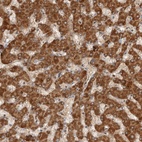 Anti-SWT1 Antibody