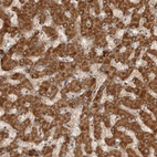 Anti-SWT1 Antibody