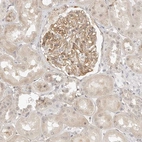 Immunohistochemical staining of human kidney shows moderate cytoplasmic-membranous positivity in cells in glomeruli and weak cytoplasmic positivity in cells in tubules.
