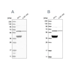 Western blot analysis using Anti-TCP1 antibody HPA027337 (A) shows similar pattern to independent antibody HPA031082 (B).
