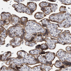 Immunohistochemical staining of human placenta shows moderate cytoplasmic positivity in trophoblastic cells.