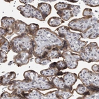 Immunohistochemical staining of human placenta shows moderate cytoplasmic positivity in trophoblastic cells.