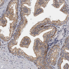 Immunohistochemical staining of human prostate shows moderate cytoplasmic positivity in glandular cells.