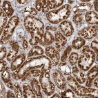 Immunohistochemical staining of human kidney shows strong granular cytoplasmic positivity in cells in tubules.