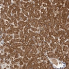 Immunohistochemical staining of human liver shows strong granular cytoplasmic positivity in hepatocytes.