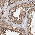 Immunohistochemical staining of human testis shows strong granular 
cytoplasmic positivity in cells in seminiferous ducts.