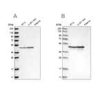 Western blot analysis using Anti-FH antibody HPA027341 (A) shows similar pattern to independent antibody HPA025770 (B).