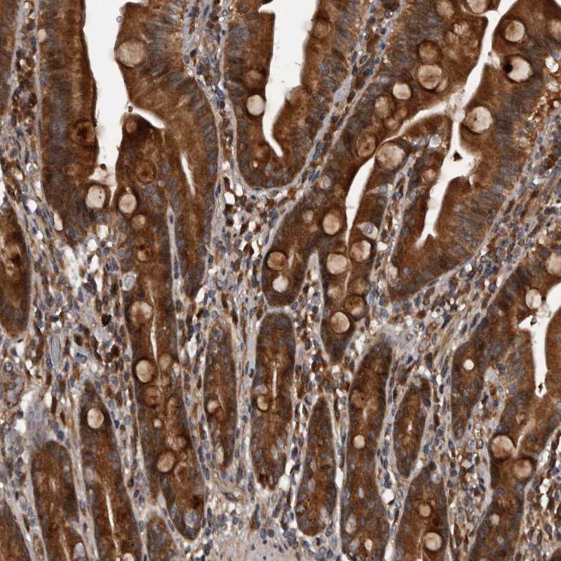 Anti-SERTAD4 Antibody