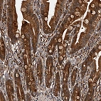 Anti-SERTAD4 Antibody