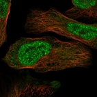 Immunofluorescent staining of human cell line U-2 OS shows localization to nucleoplasm & cytosol.