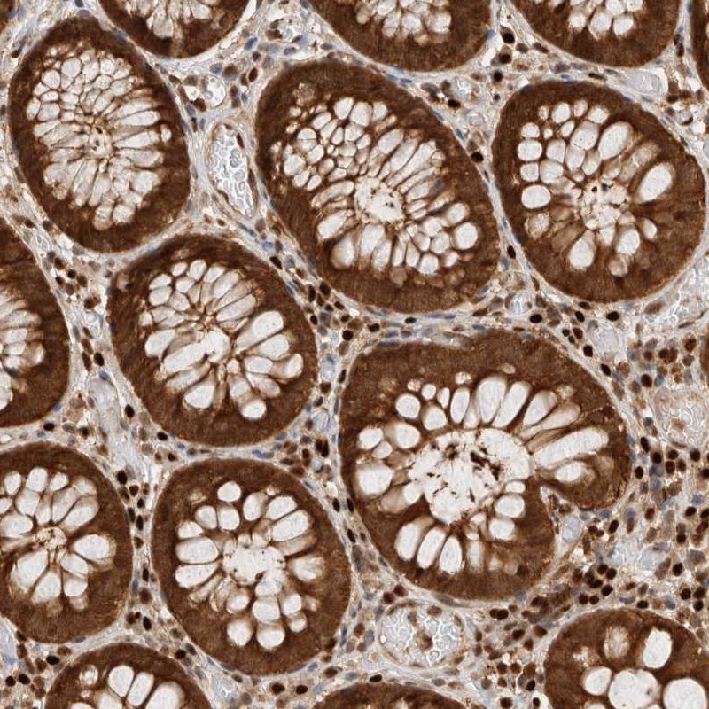 Anti-SNRNP40 Antibody
