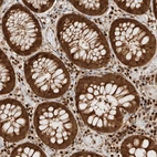 Anti-SNRNP40 Antibody