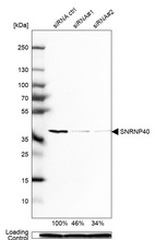 Western blot analysis in Rh30 cells transfected with control siRNA, target specific siRNA probe #1 and #2, using Anti-SNRNP40 antibody. Remaining relative intensity is presented. Loading control: Anti-PPIB.