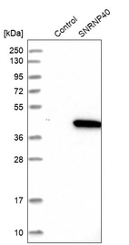 Western blot analysis in control (vector only transfected HEK293T lysate) and SNRNP40 over-expression lysate (Co-expressed with a C-terminal myc-DDK tag (~3.1 kDa) in mammalian HEK293T cells, LY417730).