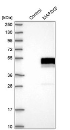 Western blot analysis in control (vector only transfected HEK293T lysate) and MAP2K5 over-expression lysate (Co-expressed with a C-terminal myc-DDK tag (~3.1 kDa) in mammalian HEK293T cells, LY408026).