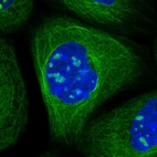 Immunofluorescent staining of human cell line A-431 shows localization to nucleoli & microtubules.