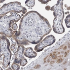 Immunohistochemical staining of human Placenta shows moderate granular cytoplasmic positivity in trophoblastic cells.