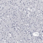 Immunohistochemical staining of human Liver shows no positivity in hepatocytes as expected.