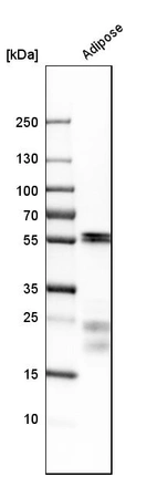 Western blot analysis in human adipose tissue tissue.